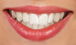 Clear removable orthodontic aligner